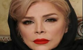 عکس تغییر چهره جنجالی شیوا خنیاگر / چه بر سر این زن آمد ؟!