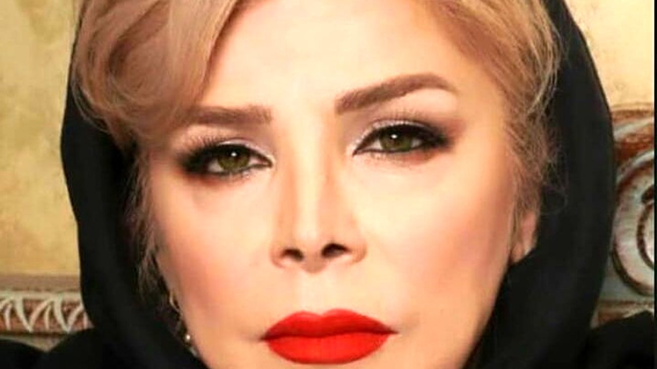 عکس تغییر چهره جنجالی شیوا خنیاگر / چه بر سر این زن آمد ؟!