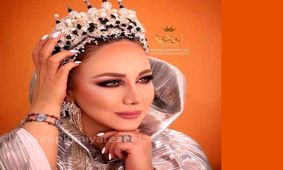 چاقی شدید بهنوش بختیاری بعد مدت‌ها نبودن  /  بهنوش بختیاری با صورت پف کرده پیداش شد